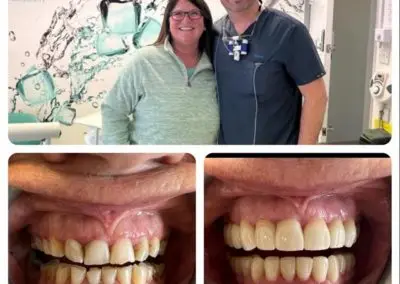 teeth1