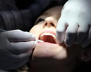 root canal treatment