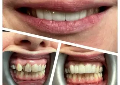 teeth7