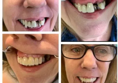 teeth8